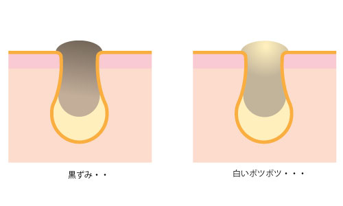 そうだ 毛穴の話をしよう 笹本真理子の美意識過剰blog