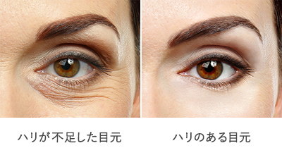 目元のシワ